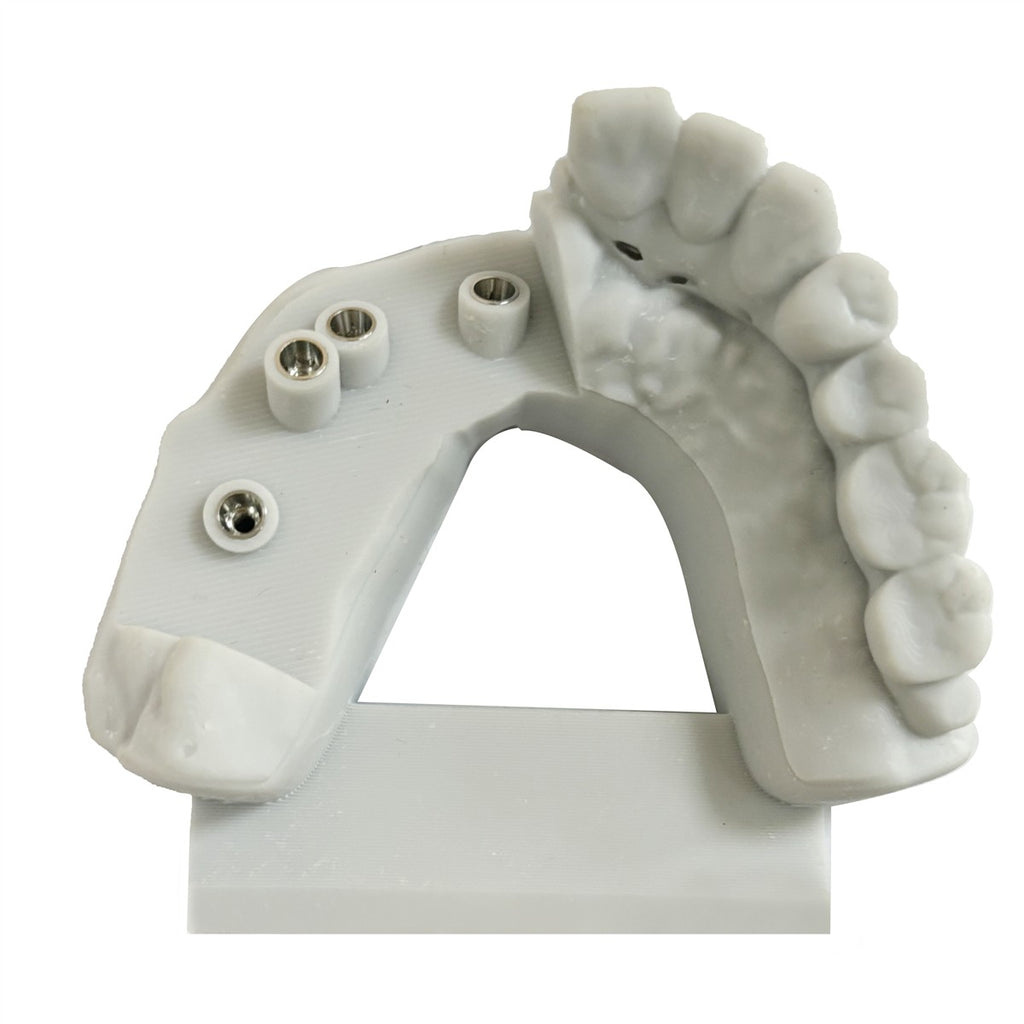 GoDoo Model Resin V3.0 - geprint tandmodel