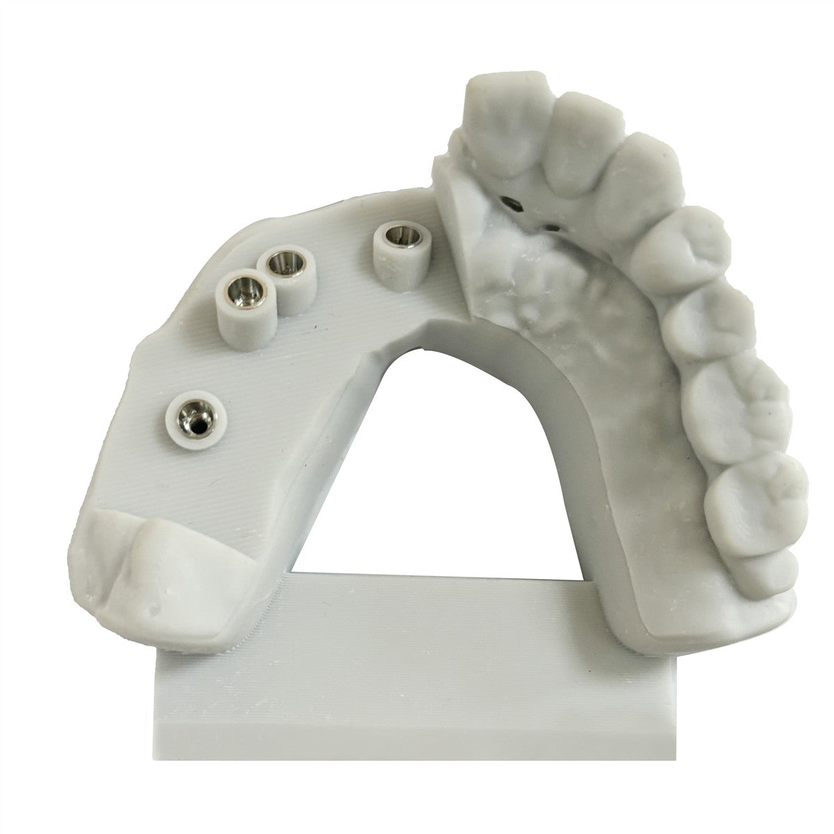 GoDoo Model Resin V3.0 - geprint tandmodel